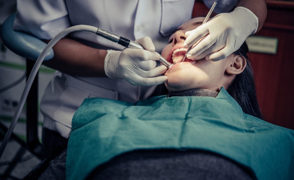 Tooth Extractions Orleans