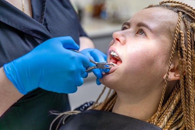 Tooth Extractions